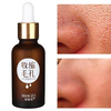 100% pur raffermissant acides hyaluroniques Essences anti-âge hydratant anti-rides