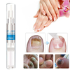 4Pcs Ongle doignon de champignon biologique arrêtent le traitement ongle dongle fongique ongle dongle