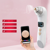 Caméra WiFi dissolvant visuel de points noirs Massage à chaud aspirateur nettoyeur de pores électrique élimination des b