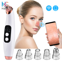 Caméra WiFi dissolvant visuel de points noirs nettoyant pour le nez pores acné élimination des boutons aspiration sous v