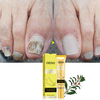 OEDO Nail Repair Traitements Crème Anti Supprimer Ongles Onychomycose Paronychia Favoriser La Croissance Des Ongles Crèm