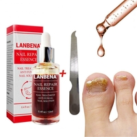 Version améliorée LANBENA Traitement liquide de réparation des ongles avec lime à ongles Anti Remove Nail Onychomycosis