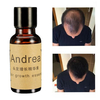 Fast Hair Growth Essence Liquid Treament 20ml Men Women