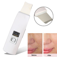 Portable Ultrasonic Skin Scrubber Facial Spa Massager Machine Equipment Blackhead Exfoliating