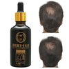 Shedding Proof Herbal Extract Liquid Hair Growth Anti Loss Activating Repair Men Women 60ml