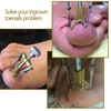 Professional Ingrown Correction Toe Nail Tool Tool Toenail traitement Pédicure outil Nail Care